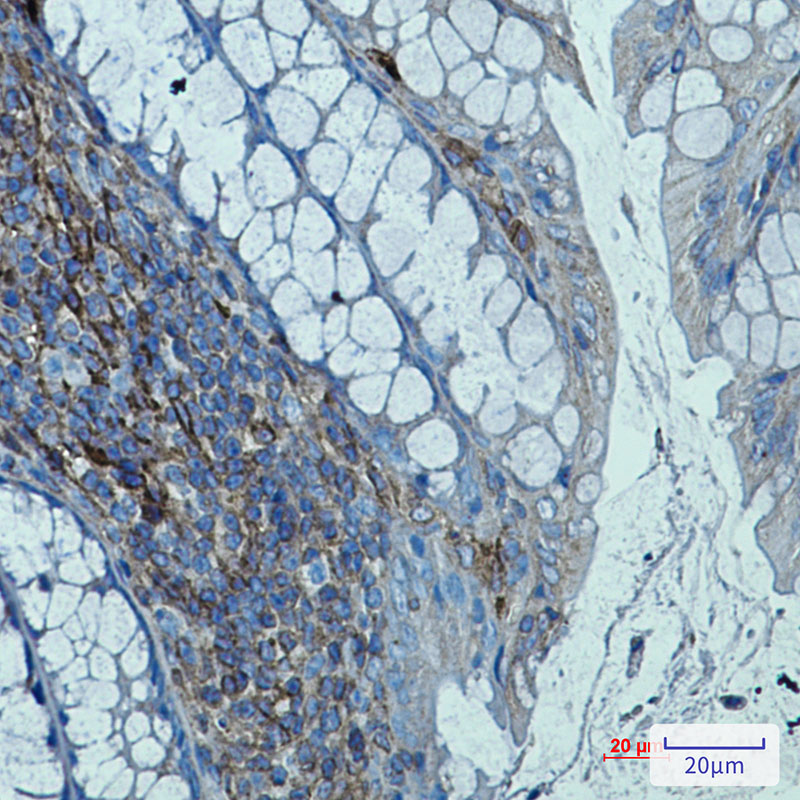beta 2 Microglobulin Rabbit mAb ABZ2336