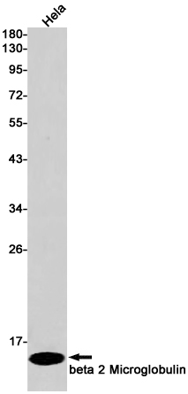 beta 2 Microglobulin Rabbit mAb ABZ2336
