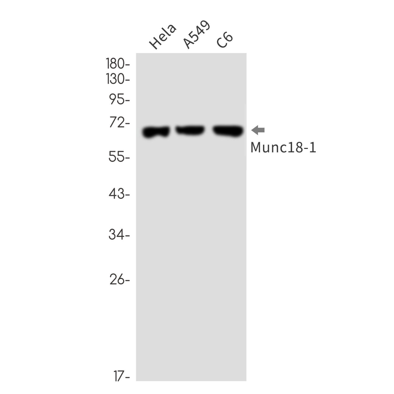 Munc18-1 Rabbit mAb ABZ2337