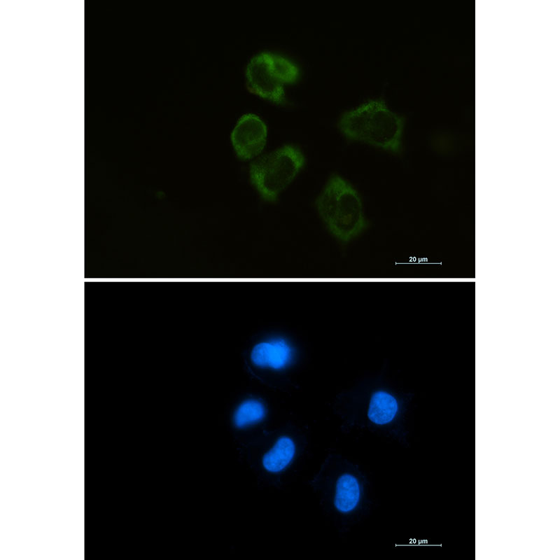 Lysozyme Rabbit mAb ABZ2338