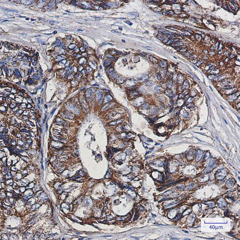 EPF Rabbit mAb ABZ2339