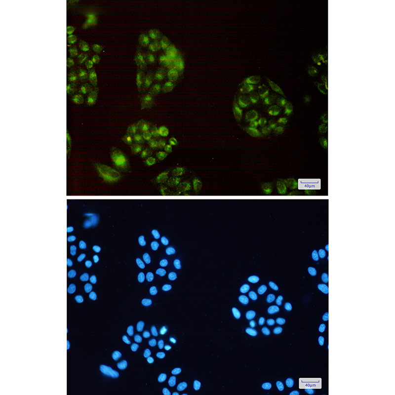 ATP6V0D1/P39 Rabbit mAb ABZ2340