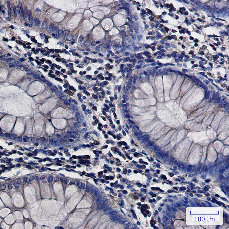 ATP6V0D1/P39 Rabbit mAb ABZ2340