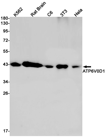 ATP6V0D1/P39 Rabbit mAb ABZ2340