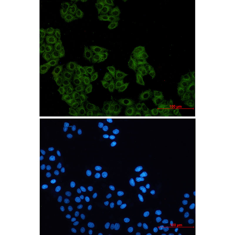 Arp2 Rabbit mAb ABZ2342