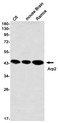 Arp2 Rabbit mAb ABZ2342