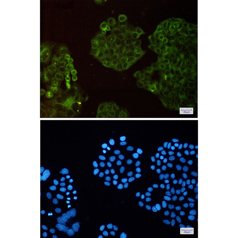 Arp3 Rabbit mAb ABZ2343