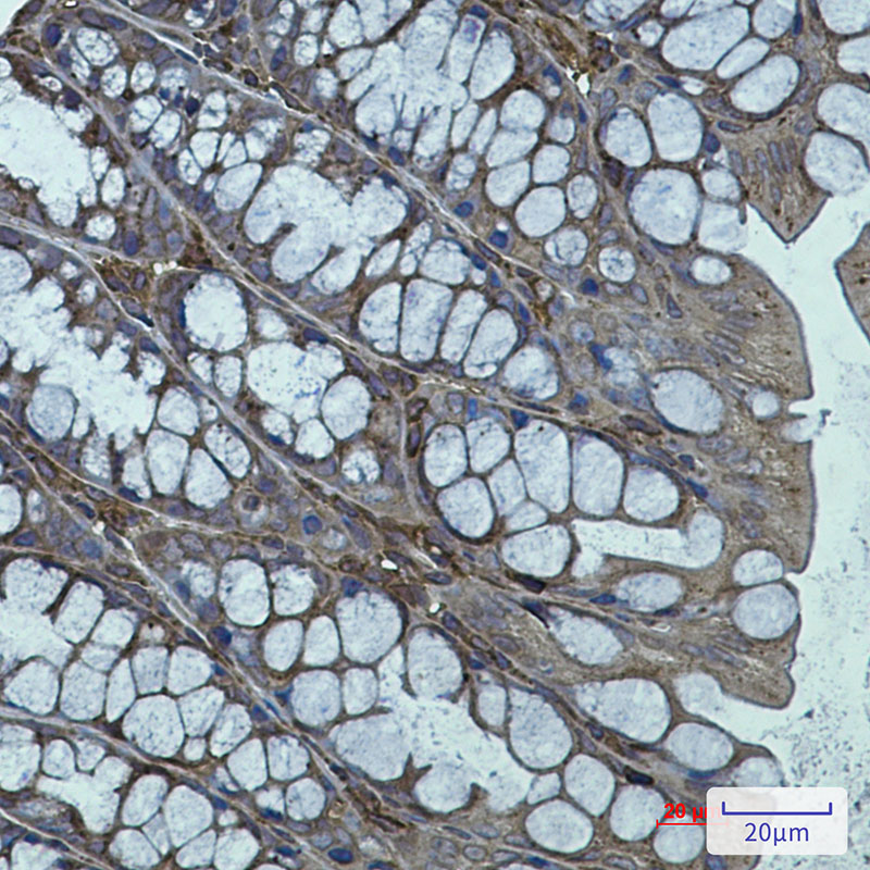 Arp3 Rabbit mAb ABZ2343