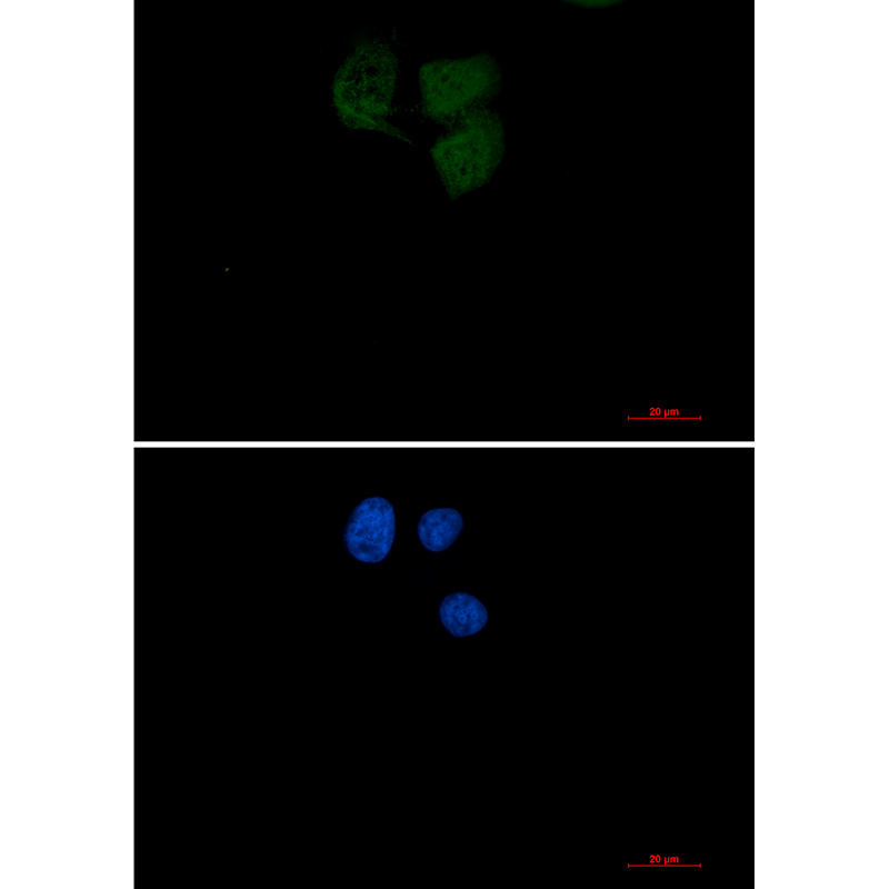 Ubiquitin Conjugating Enzyme E2 N Rabbit mAb ABZ2344