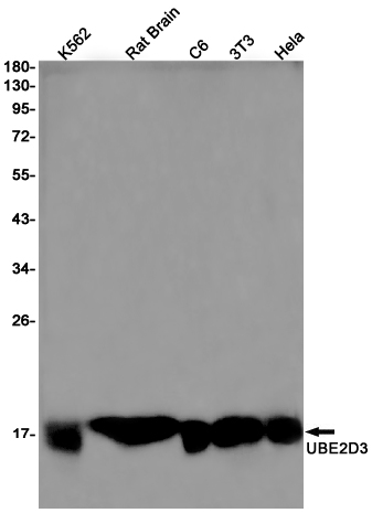 Ubiquitin Conjugating Enzyme E2 D3 Rabbit mAb ABZ2345