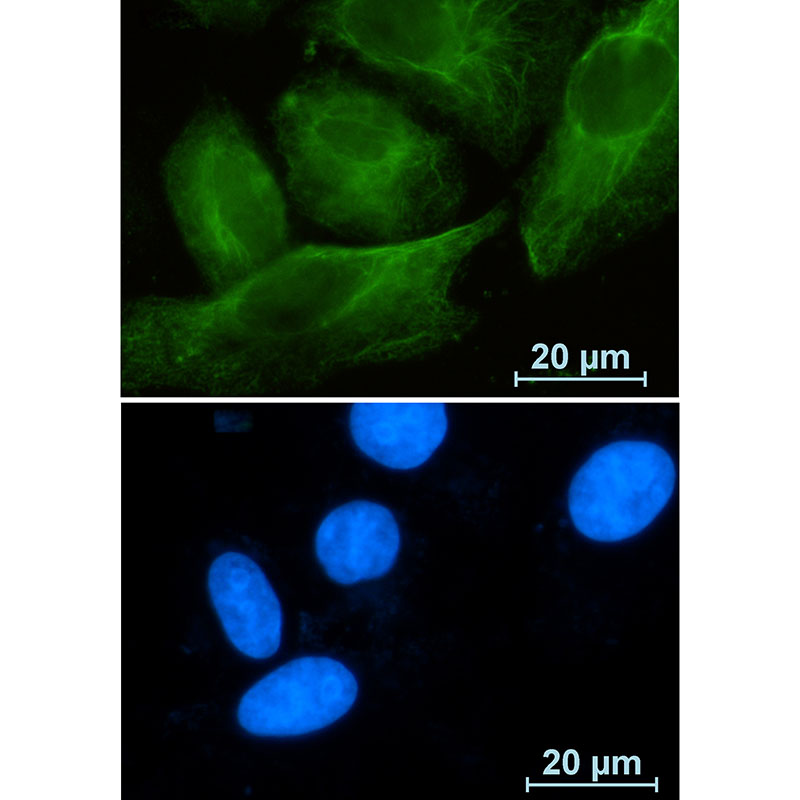 RAB10 Rabbit mAb ABZ2346