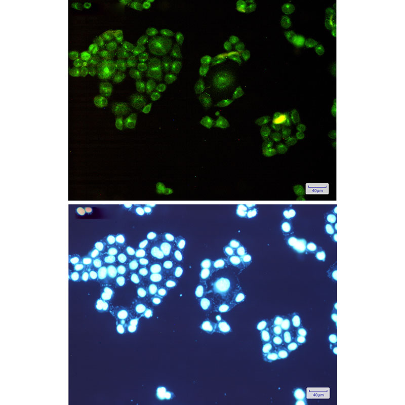 Rab8A Rabbit mAb ABZ2347