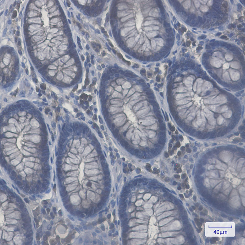 Rab8A Rabbit mAb ABZ2347