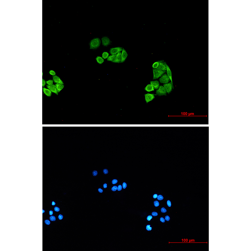 Proteasome subunit alpha type 6 Rabbit mAb ABZ2348