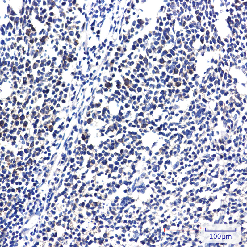 RPS20 Rabbit mAb ABZ2350
