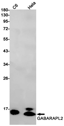 GABARAPL2/GATE-16 Rabbit mAb ABZ2353