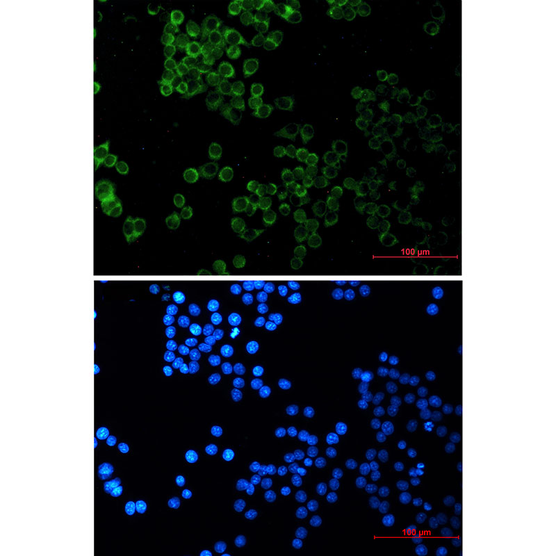 SESN2/Sestrin-2 Rabbit mAb ABZ2358