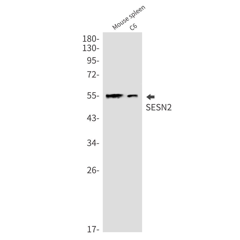 SESN2/Sestrin-2 Rabbit mAb ABZ2358