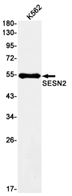 SESN2/Sestrin-2 Rabbit mAb ABZ2358