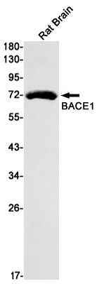 BACE1 Rabbit mAb ABZ2360