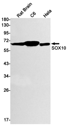 SOX10 Rabbit mAb ABZ2361