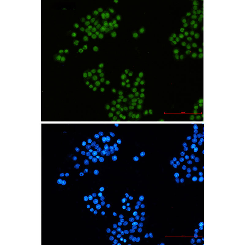 CTBP2 Rabbit mAb ABZ2363