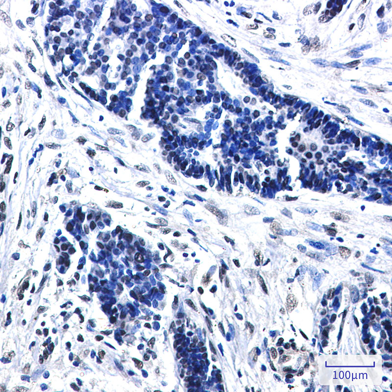 CTBP2 Rabbit mAb ABZ2363