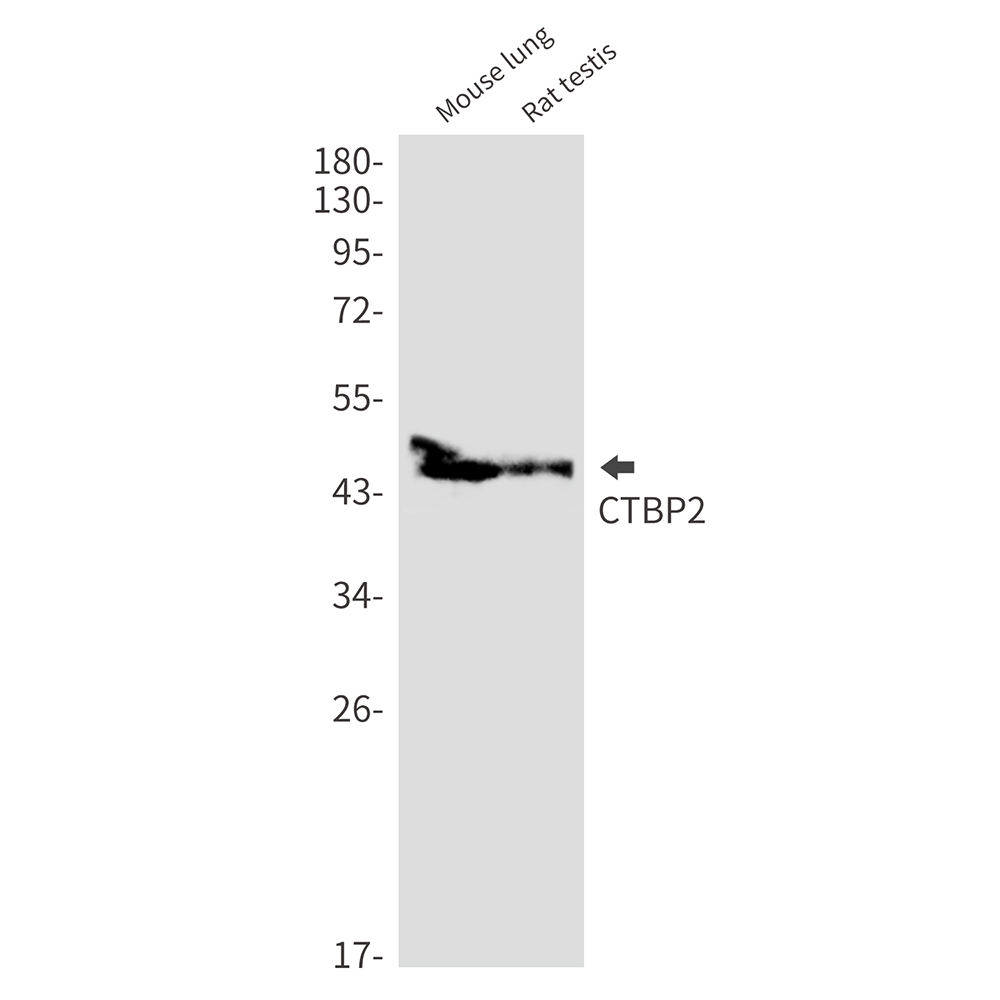 CTBP2 Rabbit mAb ABZ2363