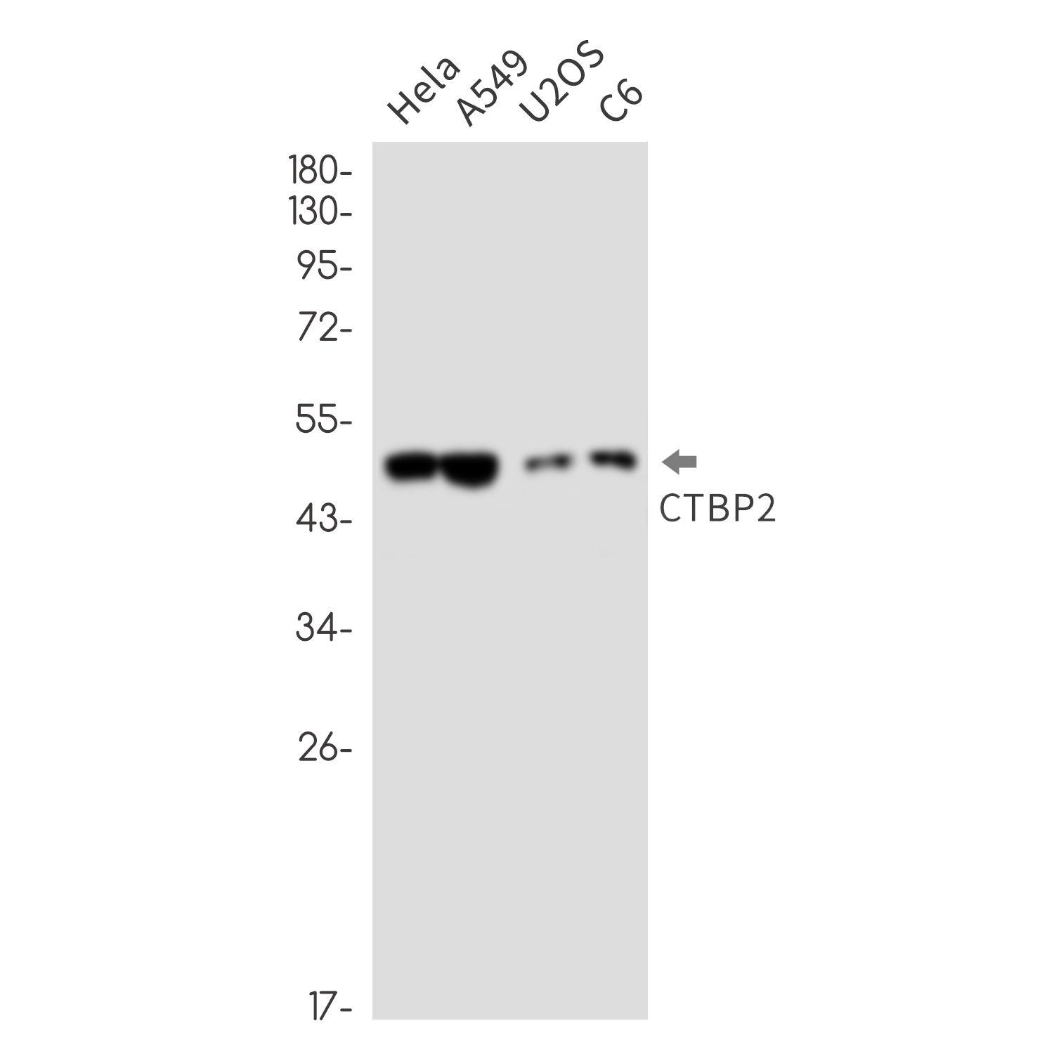 CTBP2 Rabbit mAb ABZ2363