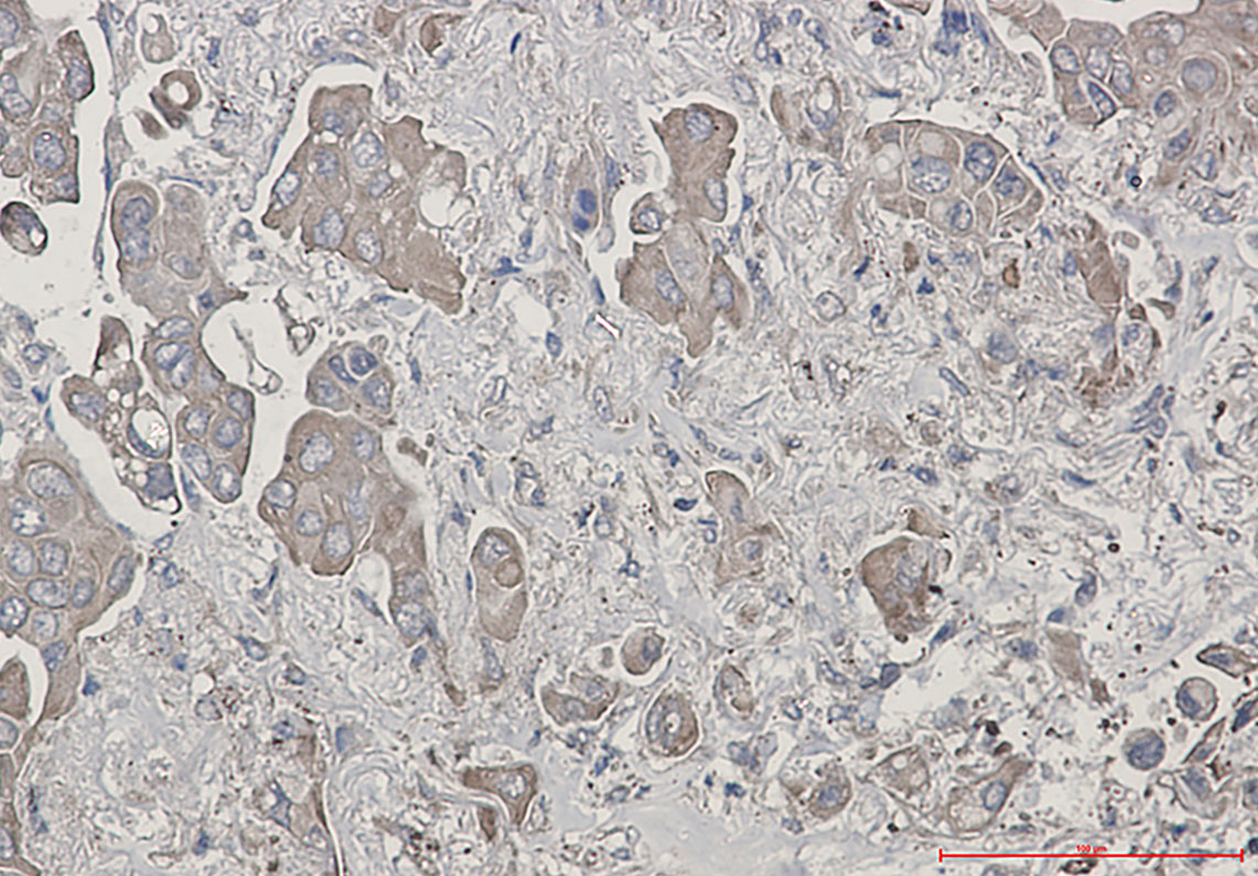Bid Rabbit mAb ABZ2364