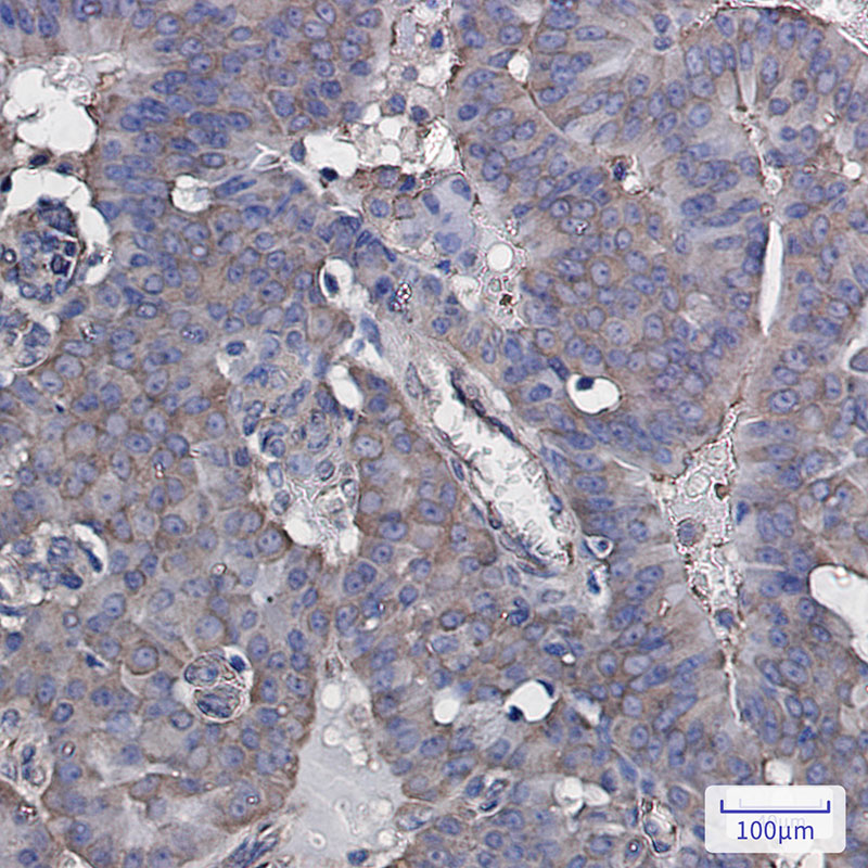 eIF3B Rabbit mAb ABZ2365