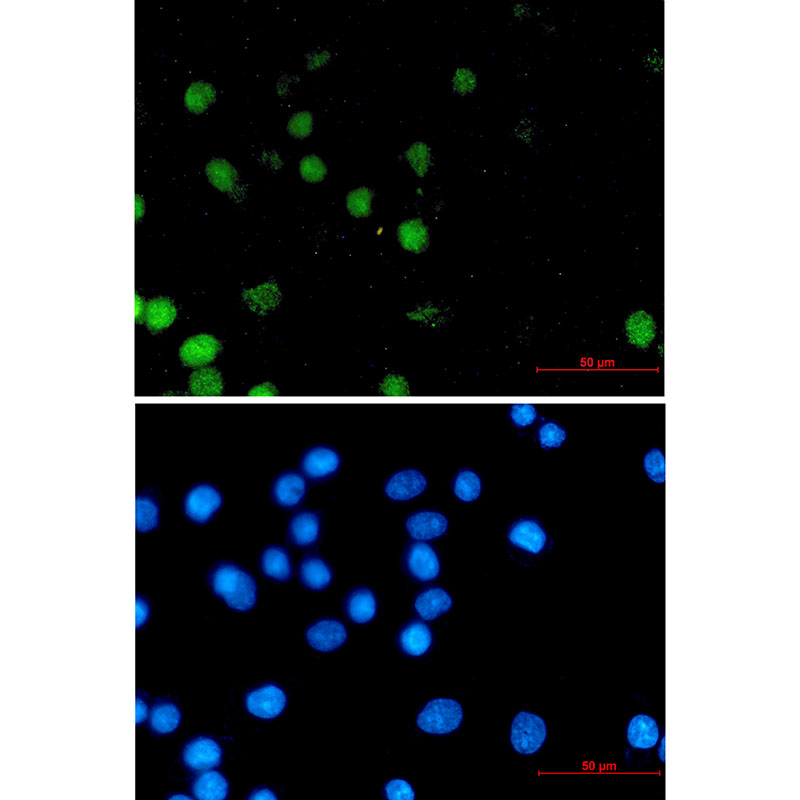 FOXA1 Rabbit mAb ABZ2366
