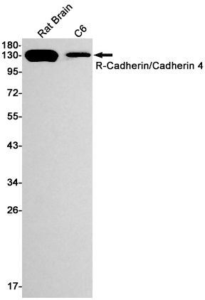 R Cadherin Rabbit mAb ABZ2368