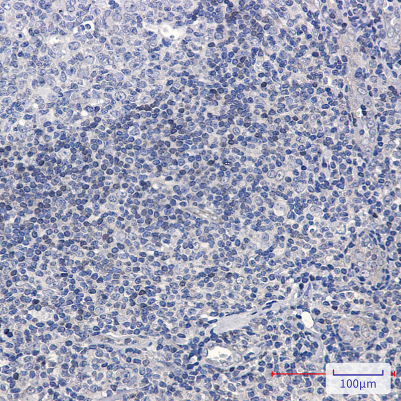 ADK Rabbit mAb ABZ2369