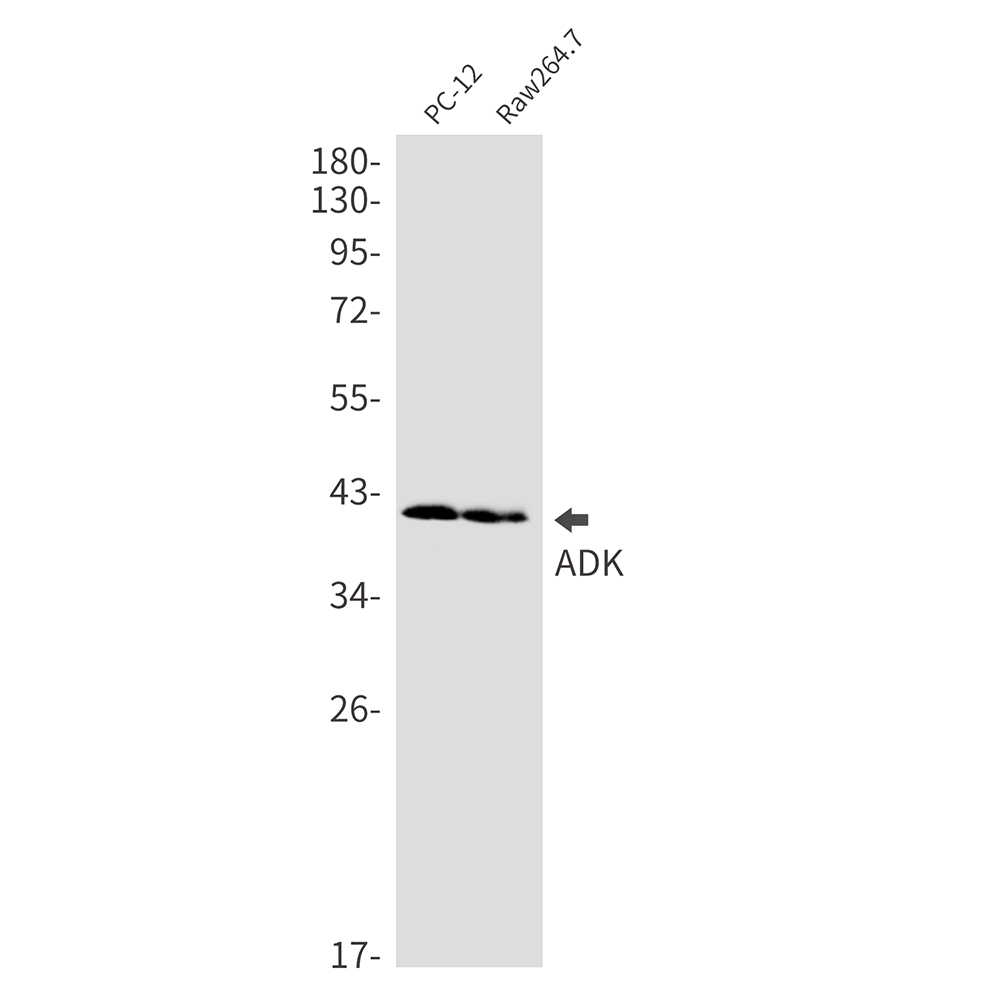 ADK Rabbit mAb ABZ2369