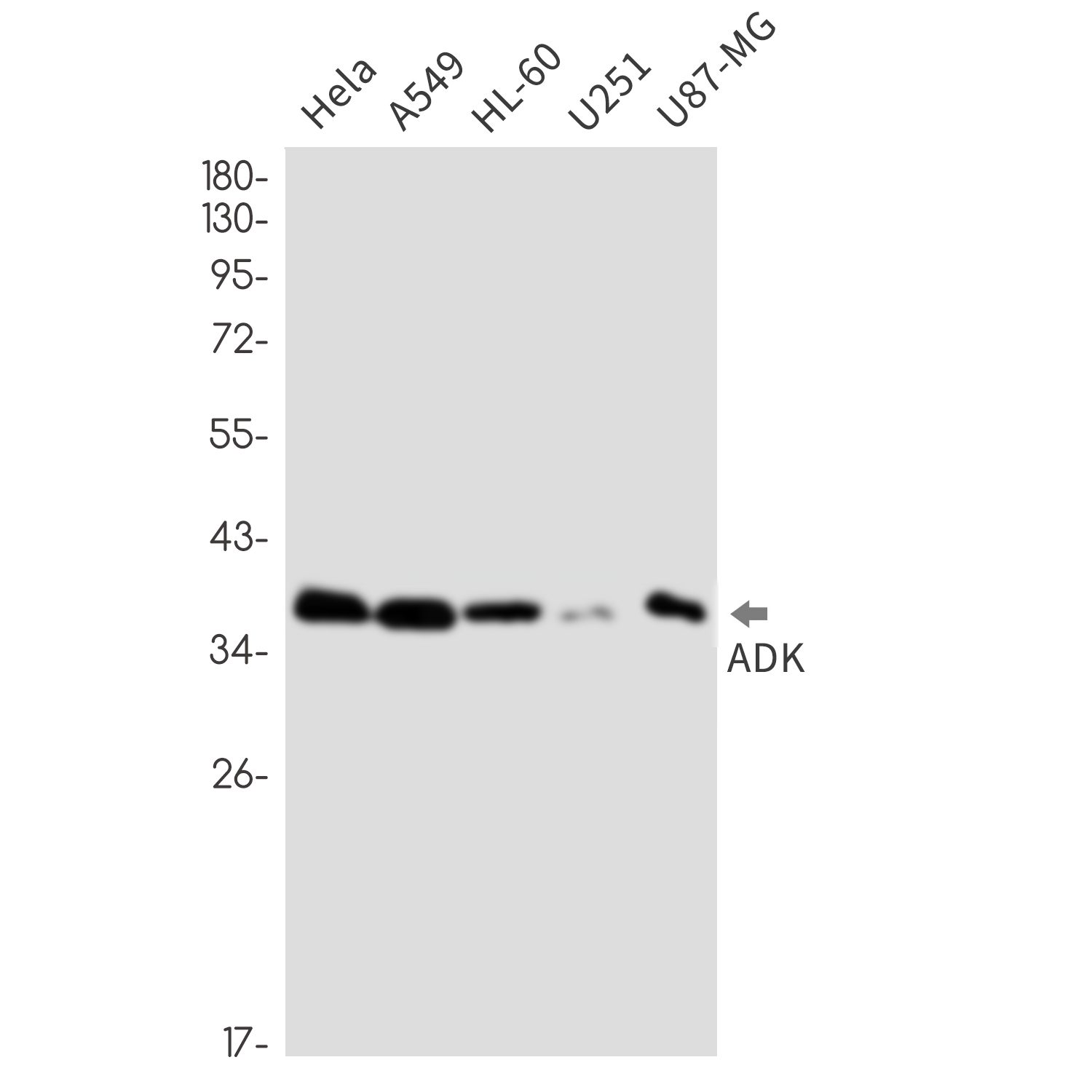 ADK Rabbit mAb ABZ2369