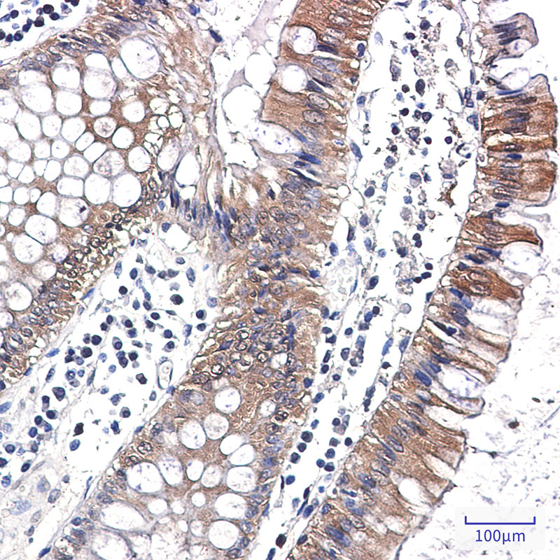 Caspase 7 Rabbit mAb ABZ2371