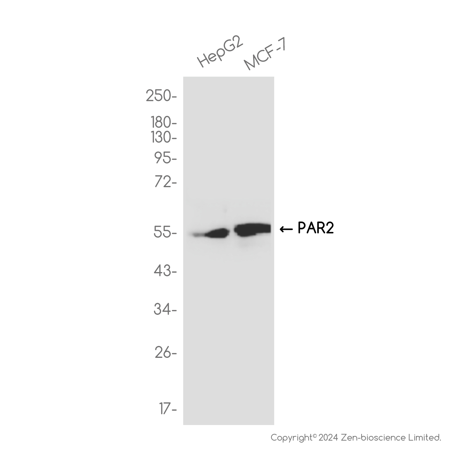 PAR2 Rabbit mAb ABZ2373