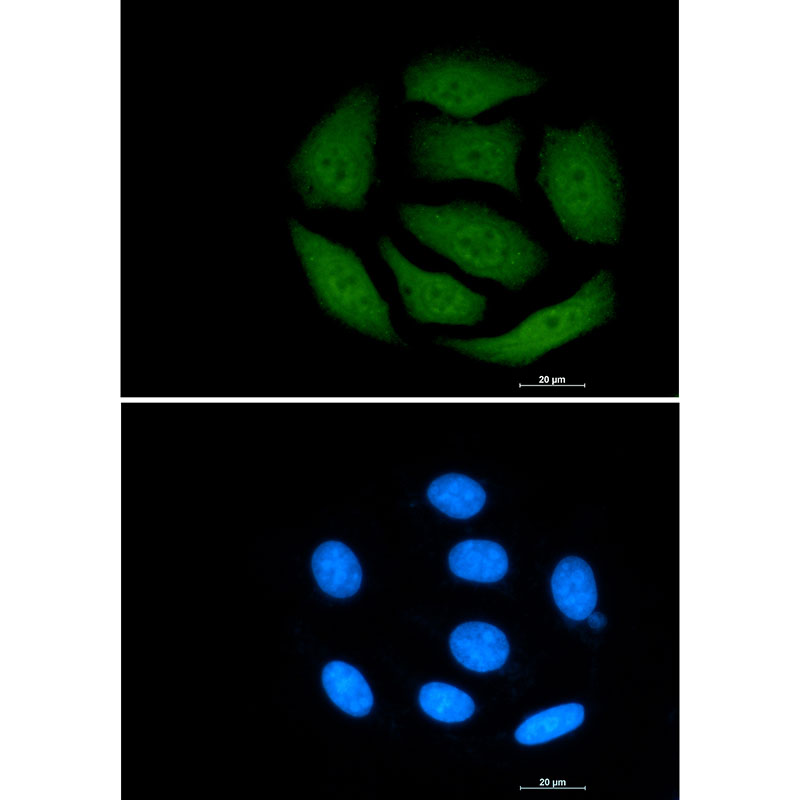VCP Rabbit mAb ABZ2374