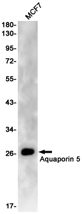 Aquaporin 5 Rabbit mAb ABZ2375