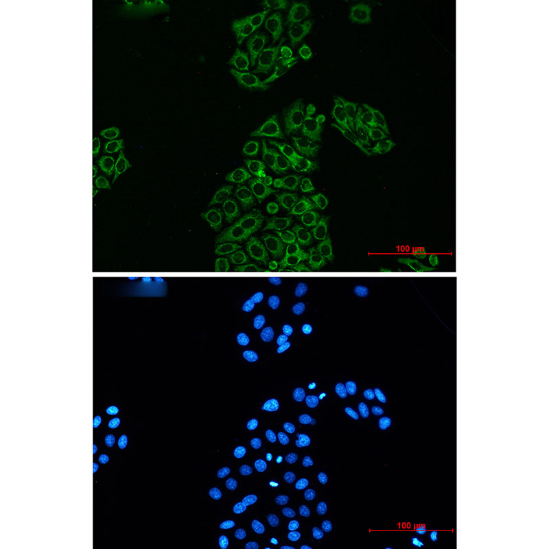 AK2 Rabbit mAb ABZ2377