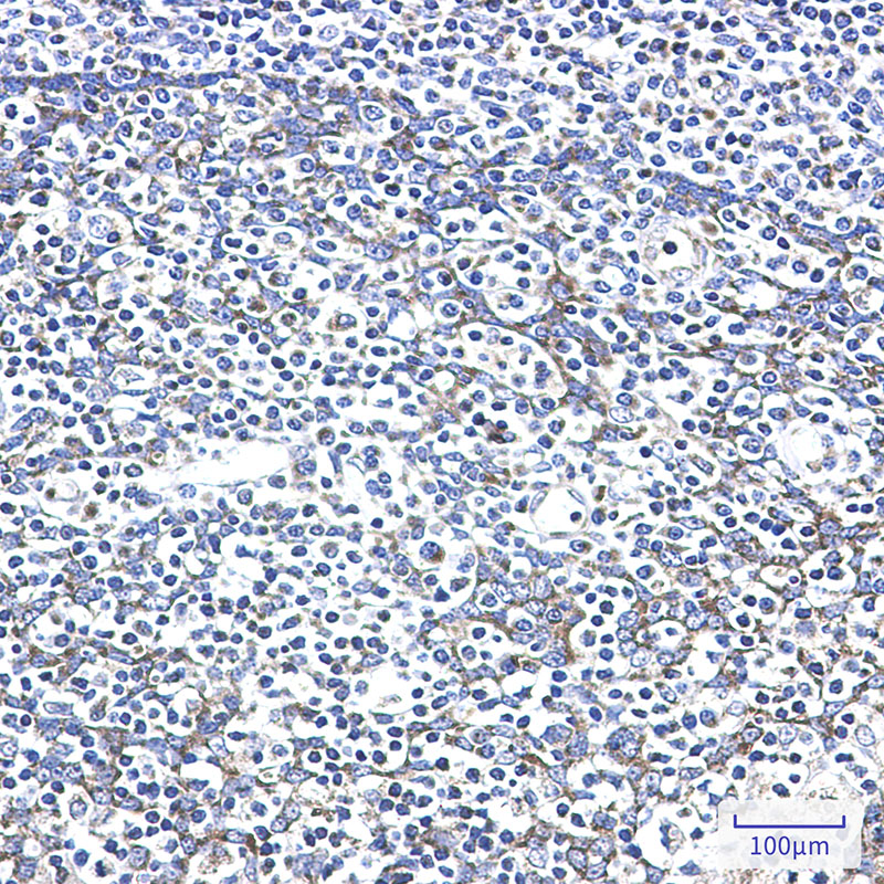 AK2 Rabbit mAb ABZ2377