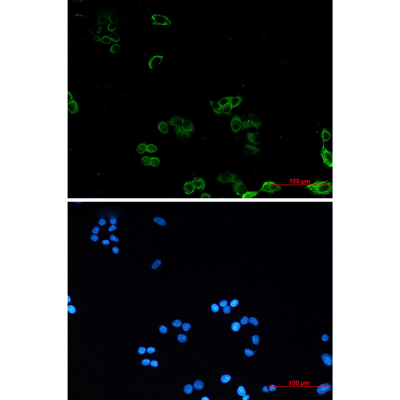 AMPK gamma 1 Rabbit mAb ABZ2381