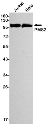 PMS2 Rabbit mAb ABZ2382
