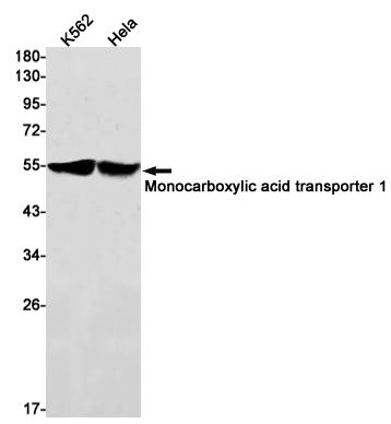 Monocarboxylic Acid Transporter 1 Rabbit mAb ABZ2386