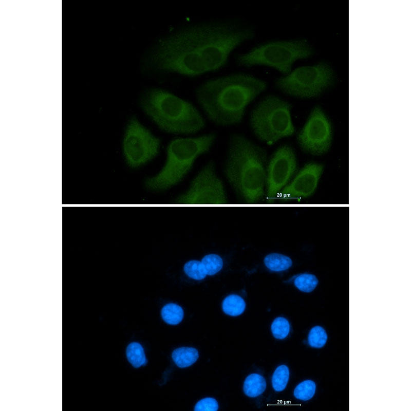 ATP Citrate lyase Rabbit mAb ABZ2387