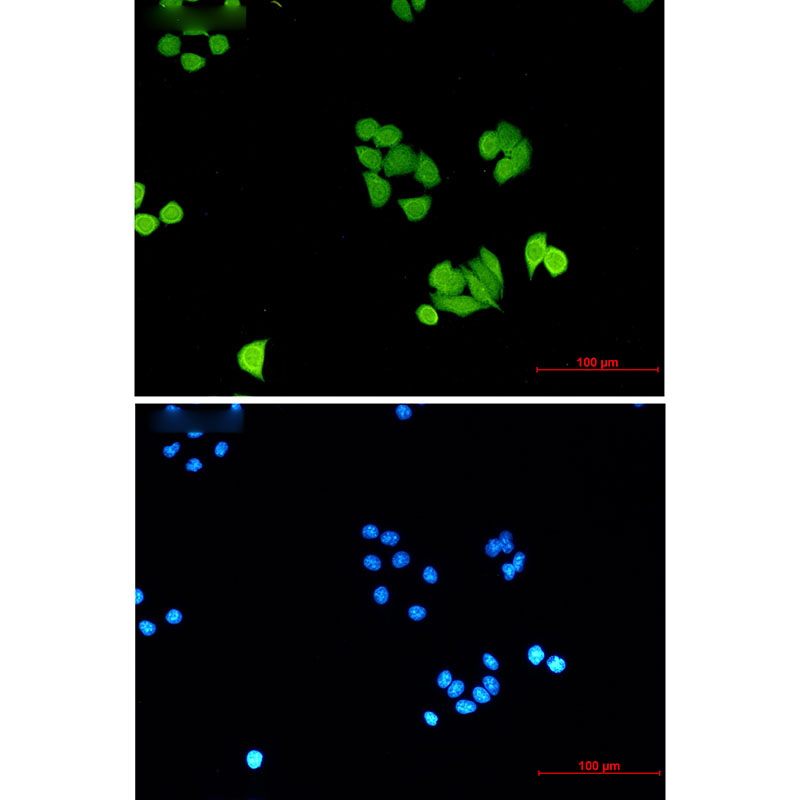 PLK1 Rabbit mAb ABZ2388