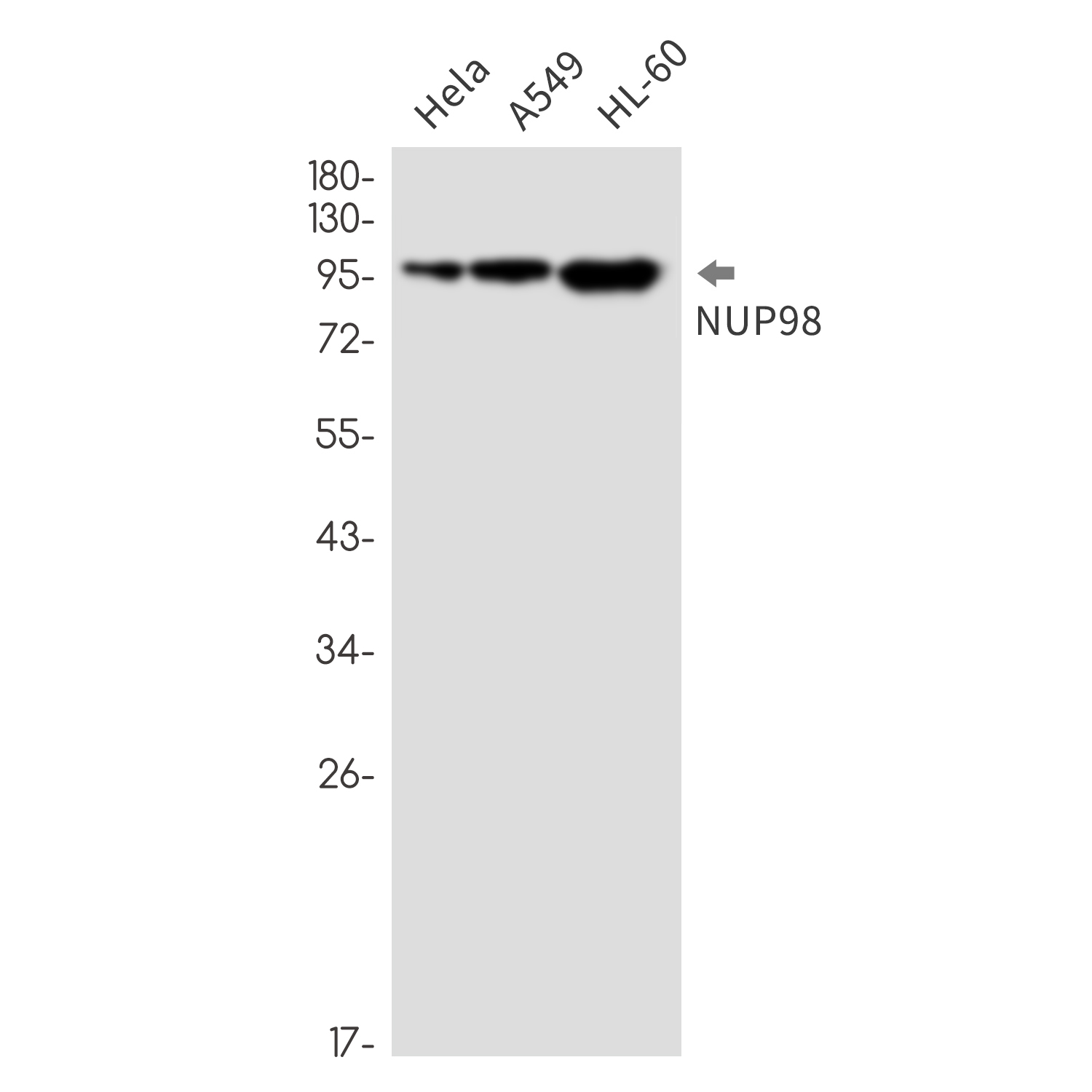 NUP98 Rabbit mAb ABZ2389