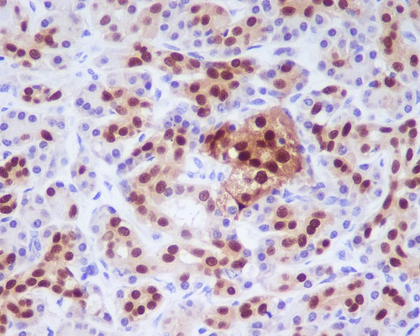 PDX1 Rabbit mAb ABZ2390