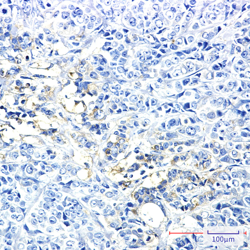 Hexokinase II Rabbit mAb ABZ2391